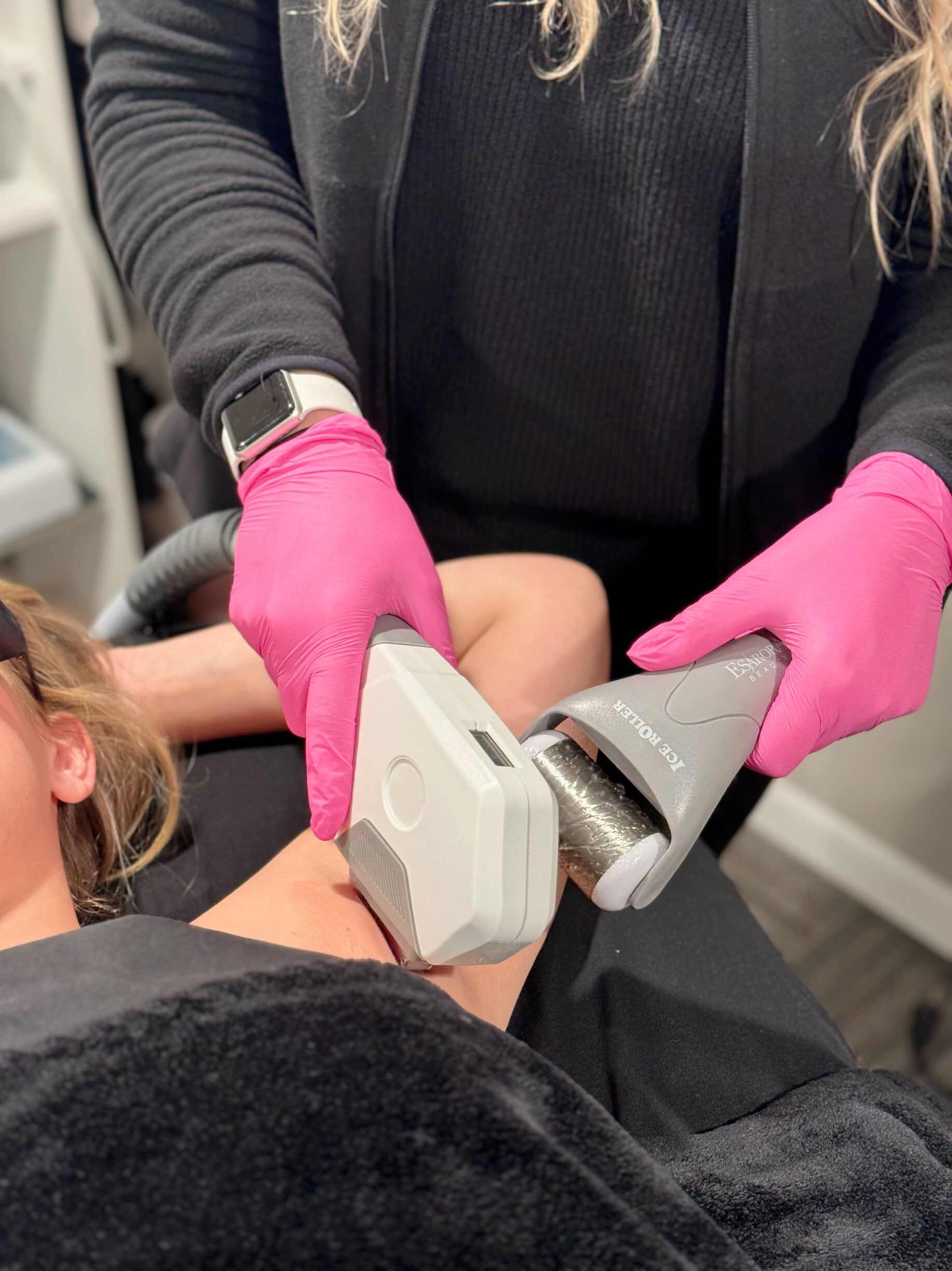Laser Hair Removal 2